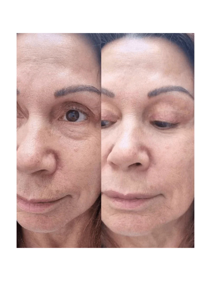 Overnight Hydrating Gel Mask + Refill - Image 3